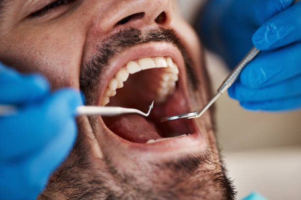 Best Emergency Dentist for Knocked-Out Tooth in Wasco, CA